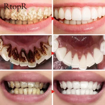 55G Mint Tænder Whitening Powder Tandpasta Dental Hvide Tænder Rengøring mundhygiejne Tandbørste Gel Fjerne Plak, Tandsten Pletter