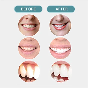 GPGP Tandblegning Kul Pulver Aktiveret Kul Tænder Whitener Pulver mundhulen Dental Tand Hygiejne Pleje Pulver